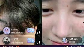 网红吃瓜二辰小霸宠,揭秘吃瓜界的“瓜王”传奇